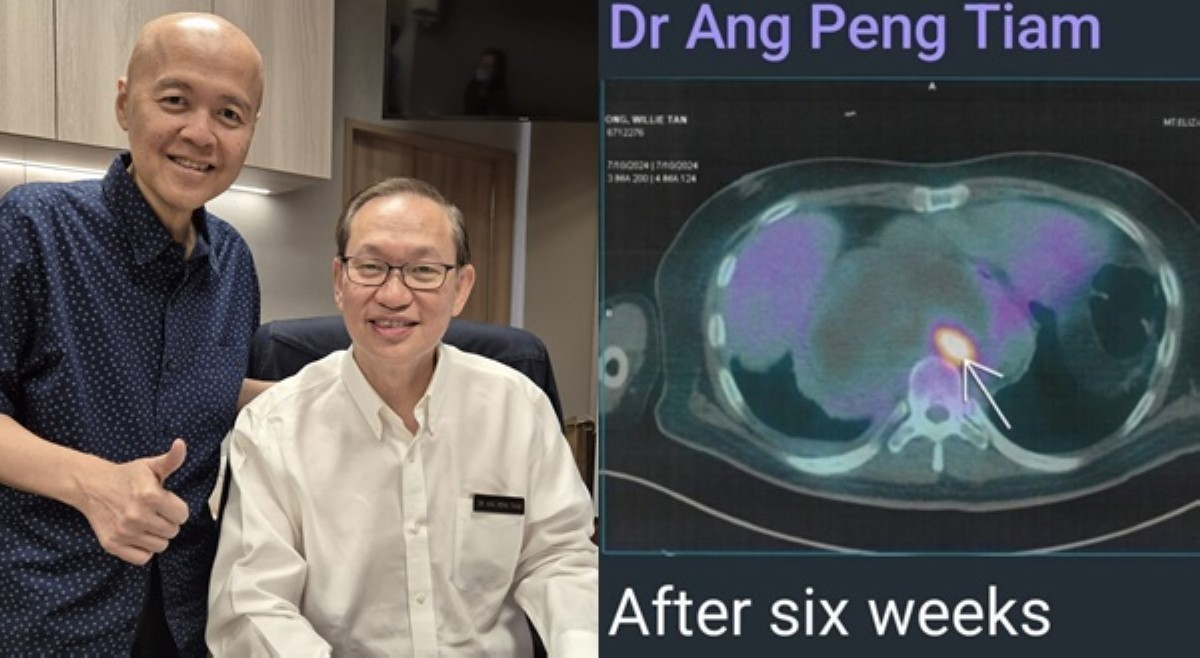 'It's really a miracle!' Doc Willie Ong, bumubuti ang kalagayan?