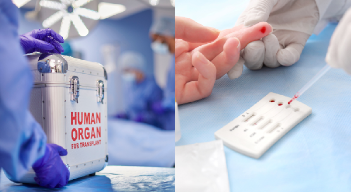 Anim na transplant patients sa Brazil nahawa ng HIV sa organ donors