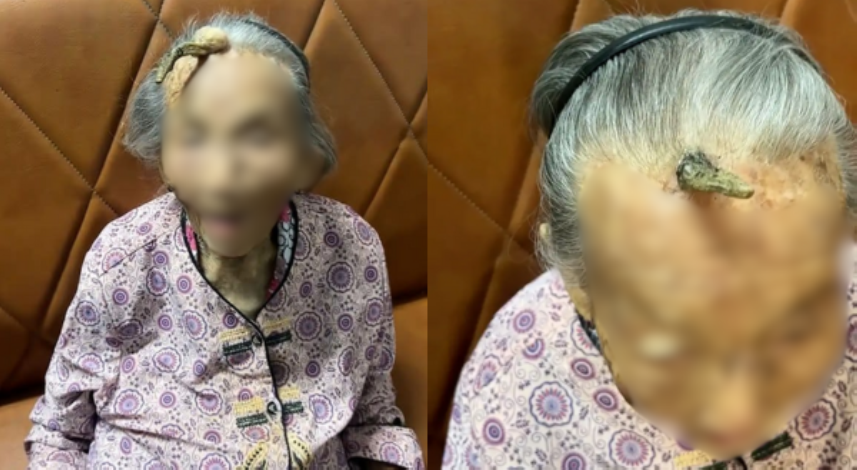 107-anyos na lola tinubuan ng sungay, pampahaba raw ng buhay?