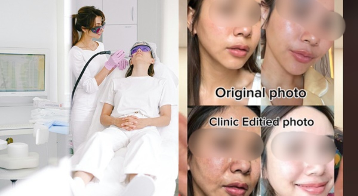 Beauty clinic, nag-sorry matapos gamitin pictures ng mga Thai influencer nang walang permiso