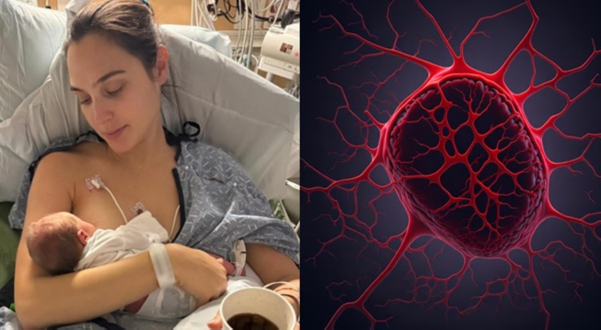 Gal Gadot, nagkaroon ng massive blood clot sa utak habang nagbubuntis